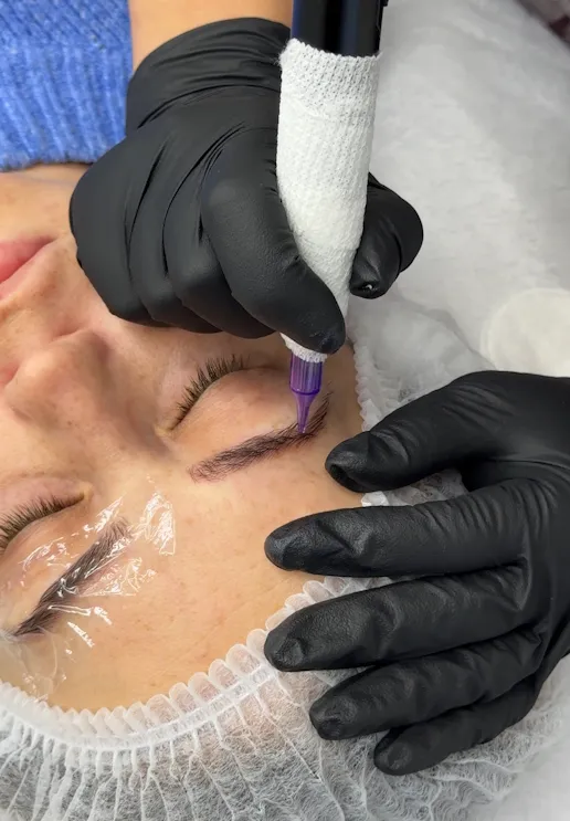 видалення татуажу