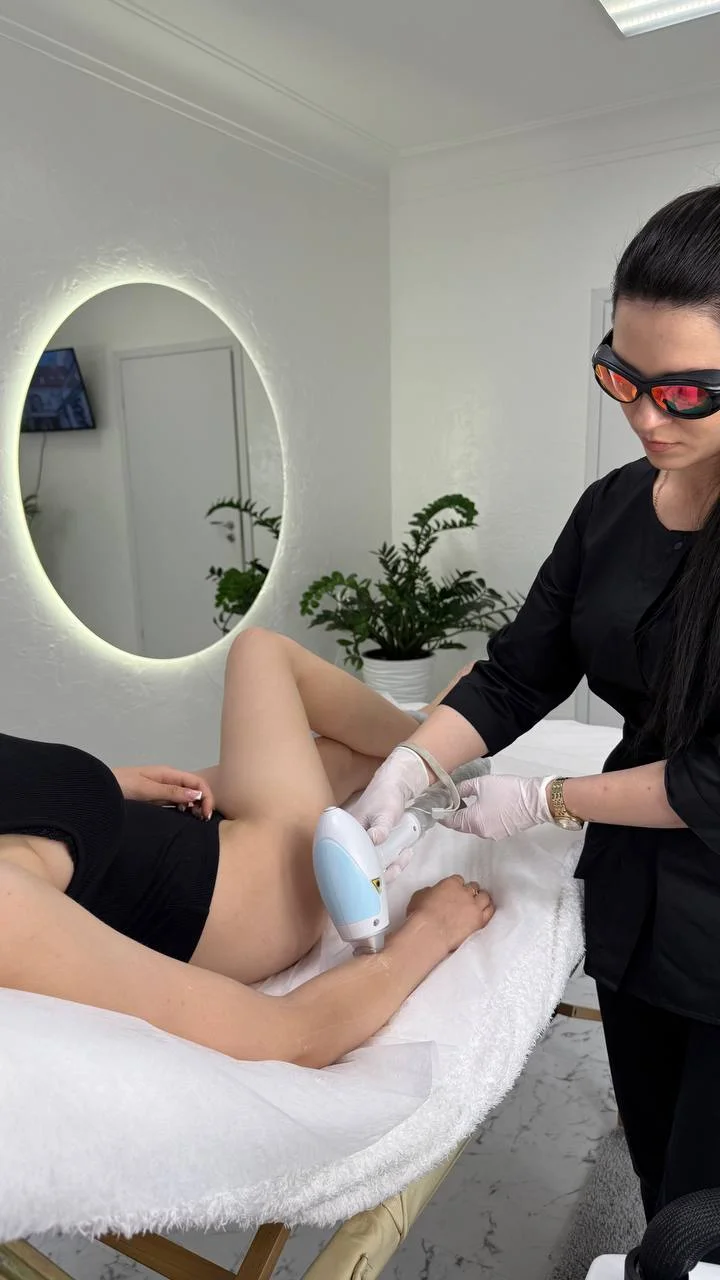 Лазерна Eпіляція